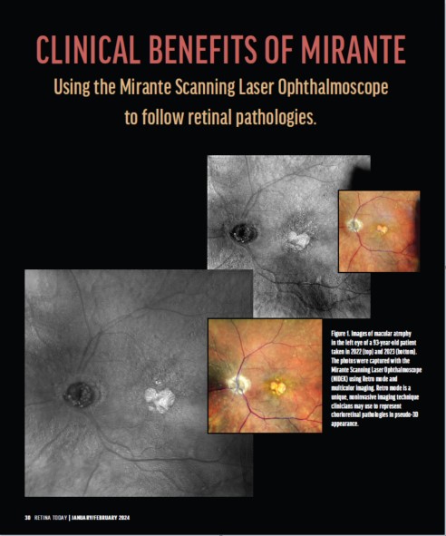 Oftalmoscópio de Varredura a Laser Mirante SLO/OCT & Mirante SLO