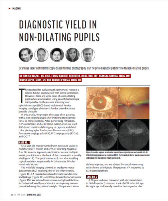 Oftalmoscópio de Varredura a Laser Mirante SLO/OCT & Mirante SLO