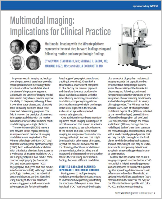 Oftalmoscópio de Varredura a Laser Mirante SLO/OCT & Mirante SLO