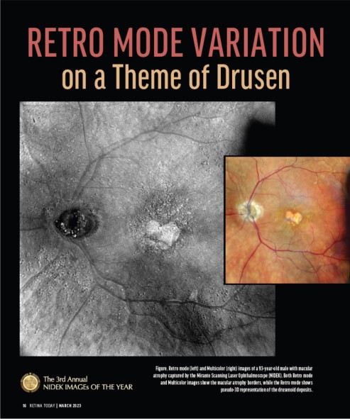 Oftalmoscópio de Varredura a Laser Mirante SLO/OCT & Mirante SLO