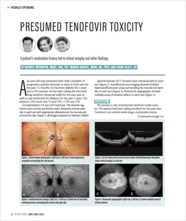 Oftalmoscópio de Varredura a Laser Mirante SLO/OCT & Mirante SLO