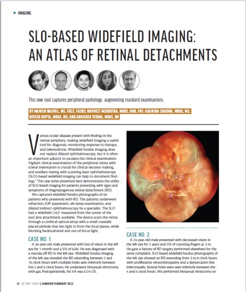 Oftalmoscópio de Varredura a Laser Mirante SLO/OCT & Mirante SLO