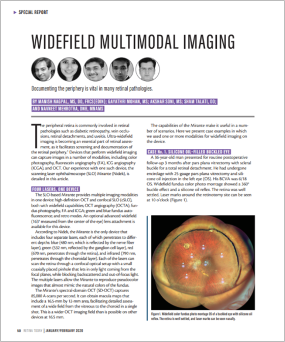 Oftalmoscópio de Varredura a Laser Mirante SLO/OCT & Mirante SLO