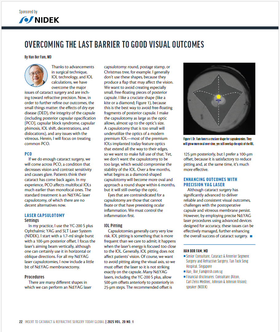 Sistema Oftálmico de Laser YAG e SLT YC-200 S plus/ YC-200