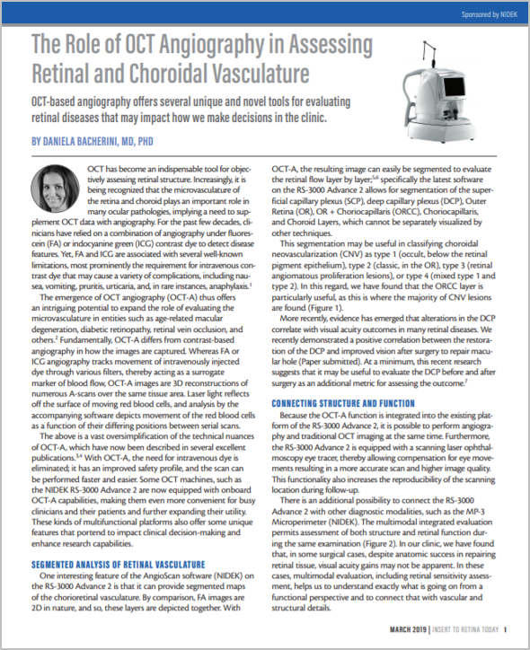 Software AngioScan – Angiografia por OCT para Mirante SLO/OCT e Retina Scan Duo 2 da NIDEK