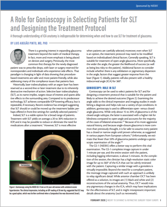 Sistema Oftálmico de Laser YAG e SLT YC-200 S plus/ YC-200