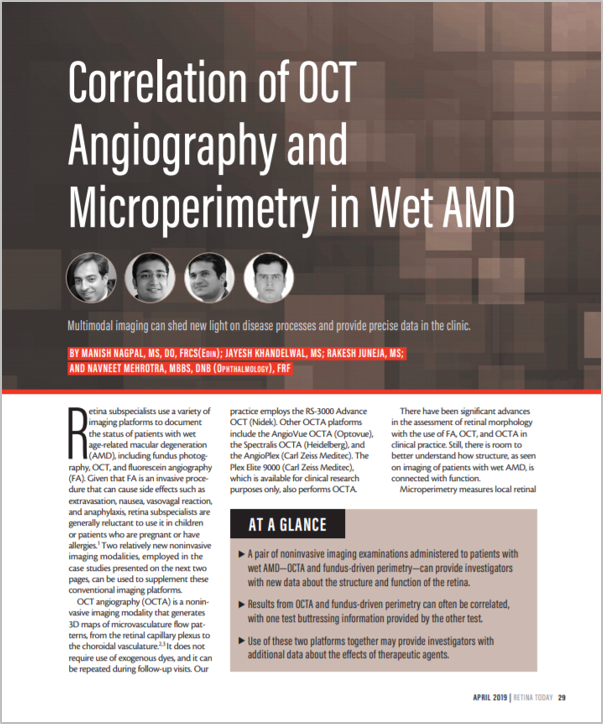 Microperímetro MP-3