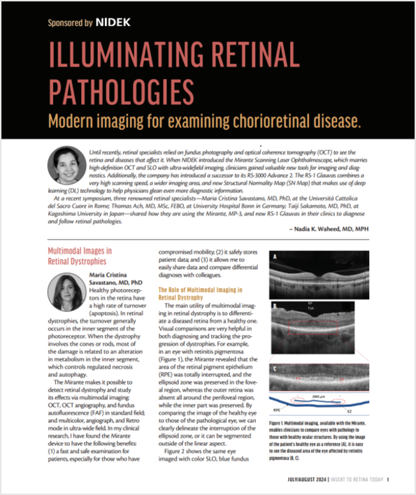 Microperímetro MP-3