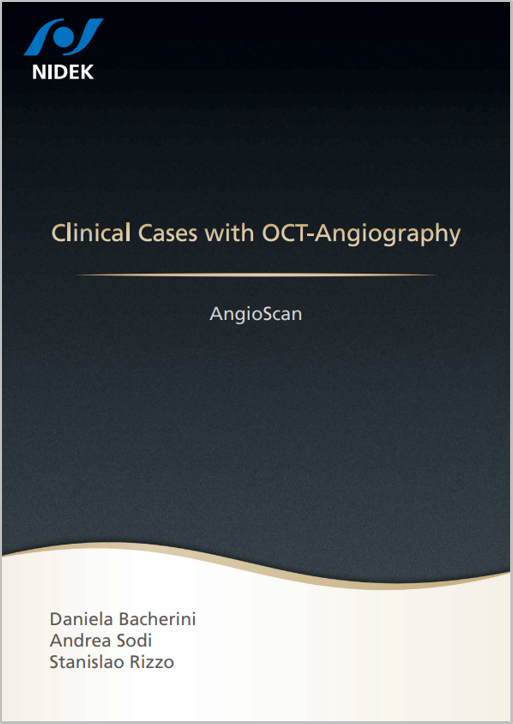 Software AngioScan – Angiografia por OCT para Mirante SLO/OCT e Retina Scan Duo 2 da NIDEK