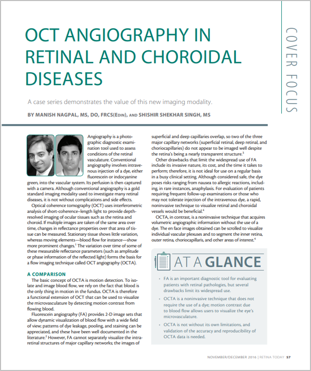 Software AngioScan – Angiografia por OCT para Mirante SLO/OCT e Retina Scan Duo 2 da NIDEK
