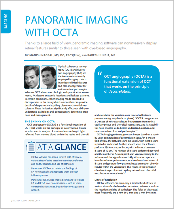 Software AngioScan – Angiografia por OCT para Mirante SLO/OCT e Retina Scan Duo 2 da NIDEK
