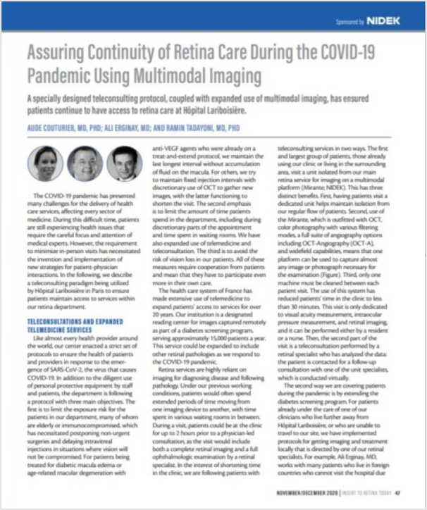 Oftalmoscópio de Varredura a Laser Mirante SLO/OCT & Mirante SLO