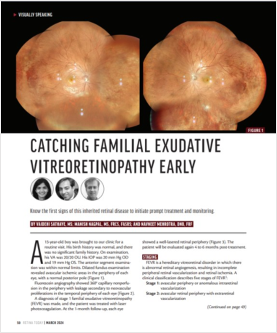 Oftalmoscópio de Varredura a Laser Mirante SLO/OCT & Mirante SLO