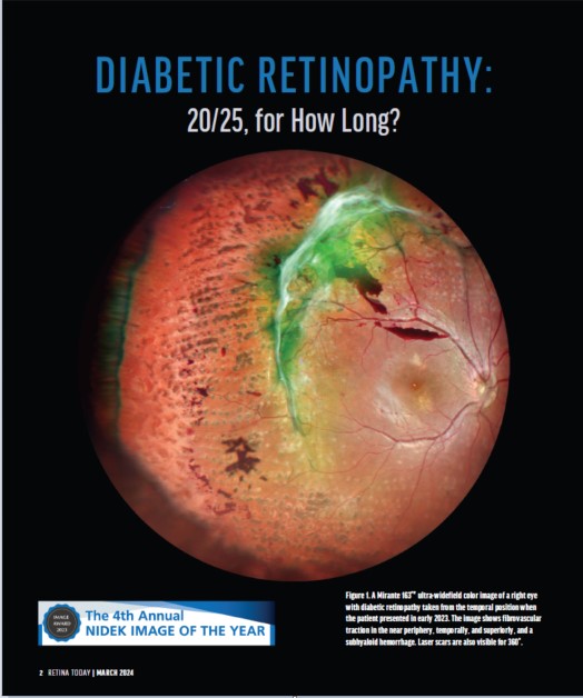 Oftalmoscópio de Varredura a Laser Mirante SLO/OCT & Mirante SLO