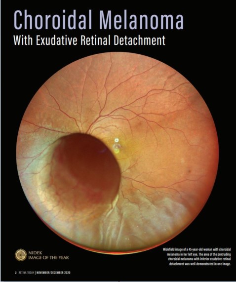 Oftalmoscópio de Varredura a Laser Mirante SLO/OCT & Mirante SLO