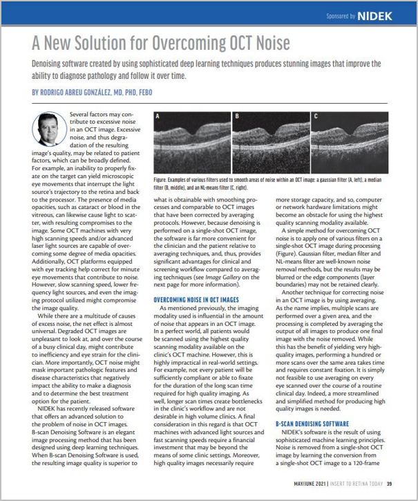 Software B-scan Denoising para a Série OCT