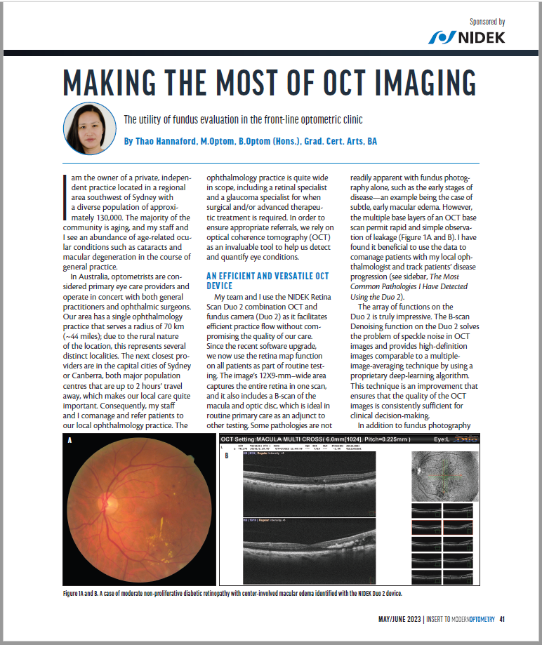 Tomógrafo de Coerência Óptica (OCT) RS-330 Retina Scan Duo 2