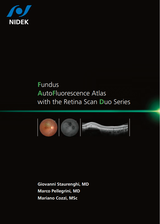 Tomógrafo de Coerência Óptica (OCT) RS-330 Retina Scan Duo 2