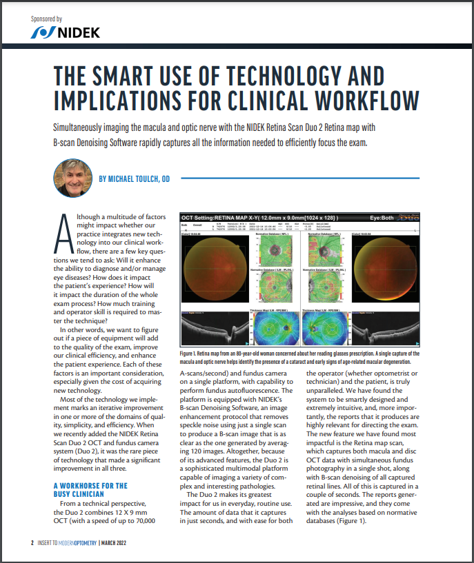 Tomógrafo de Coerência Óptica (OCT) RS-330 Retina Scan Duo 2