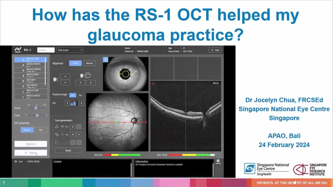 APAO 2024: How Has the RS-1 OCT Helped My Glaucoma Practice?