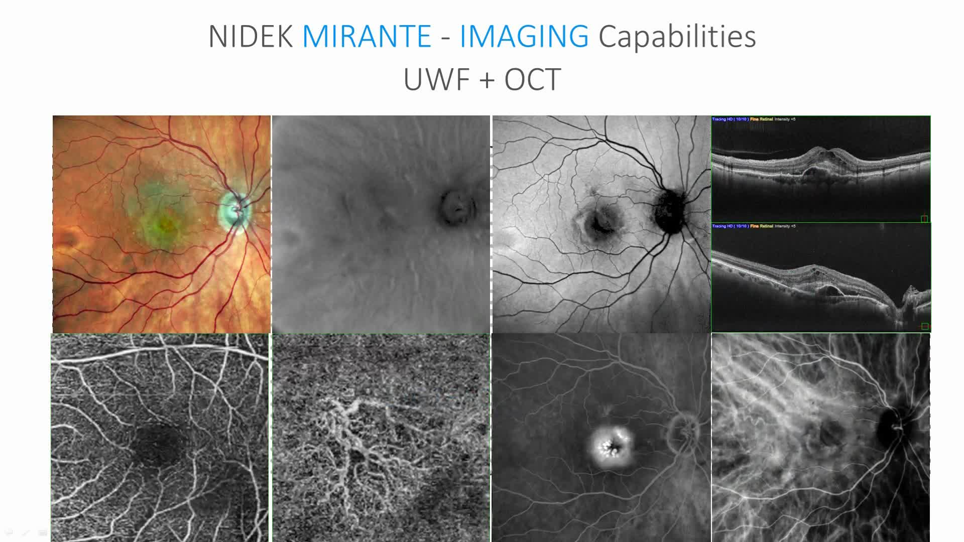 FLORetina 2019