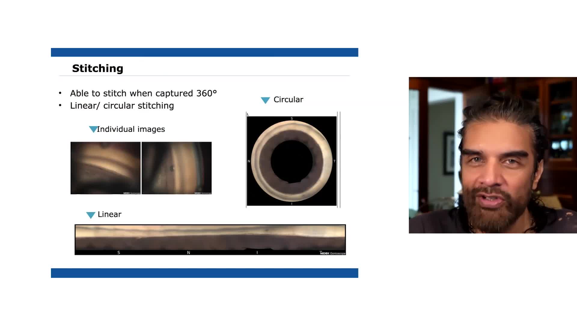 NIDEK Gonioscope Imaging (spanish)