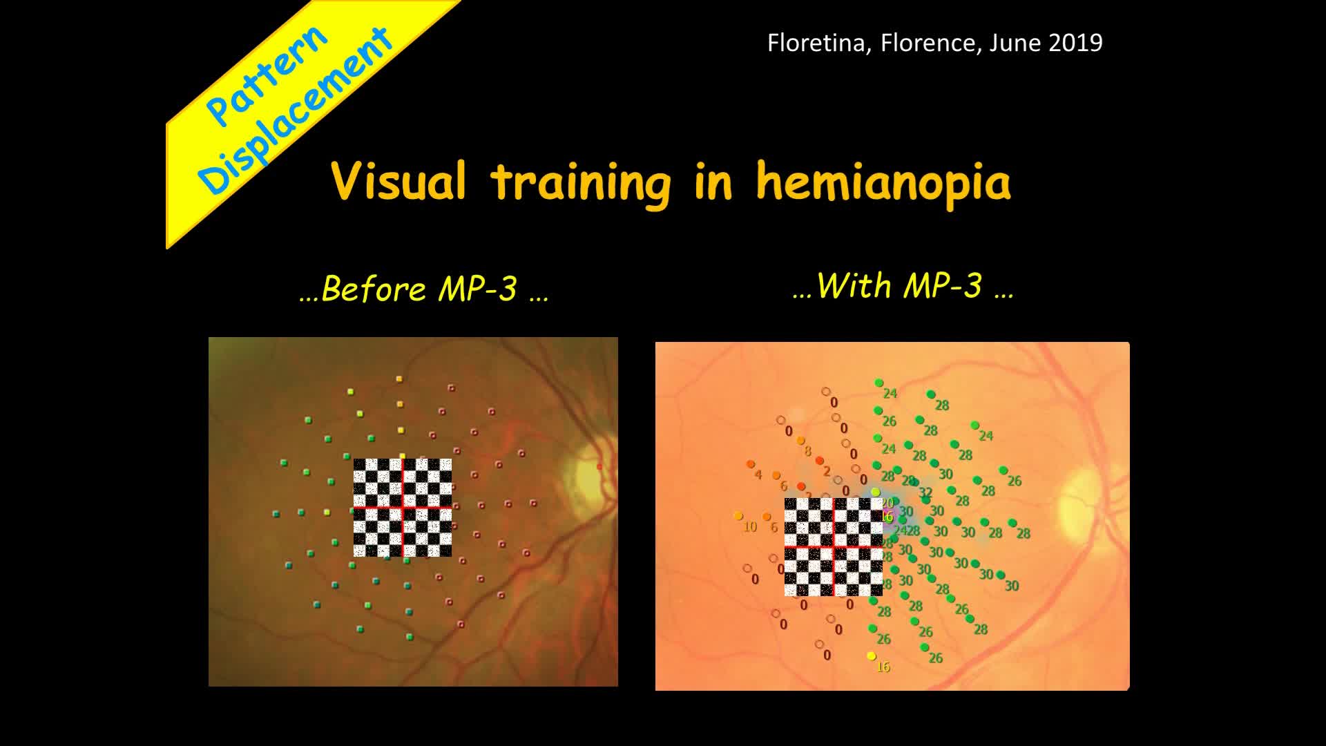 FLORetina 2019 (MP-3)